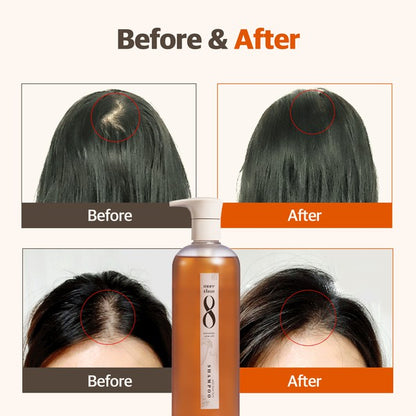 Matsutake Stem Cell Anti-Hair Loss Shampoo 16.2 OZ Morethan8